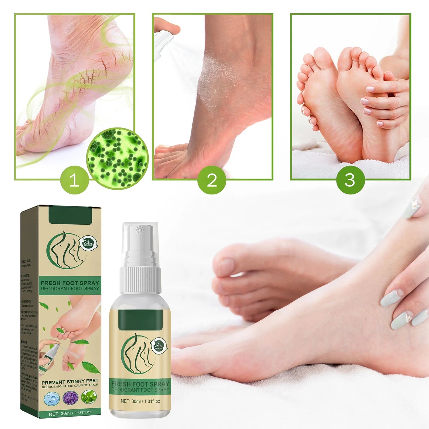 Athletes Foot Spray Athletes Foot Spray Toenail Feet Smelly Feet Itchy 20Ml Spray
